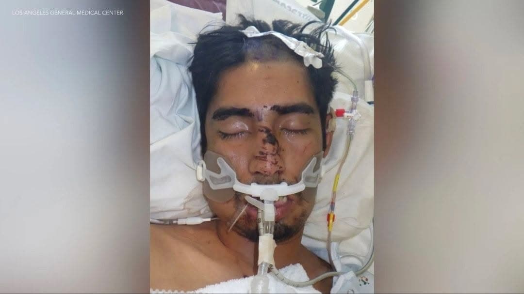 Public Asked to Help Identify Hospitalized Man Found in Valyermo LOS ANGELES...