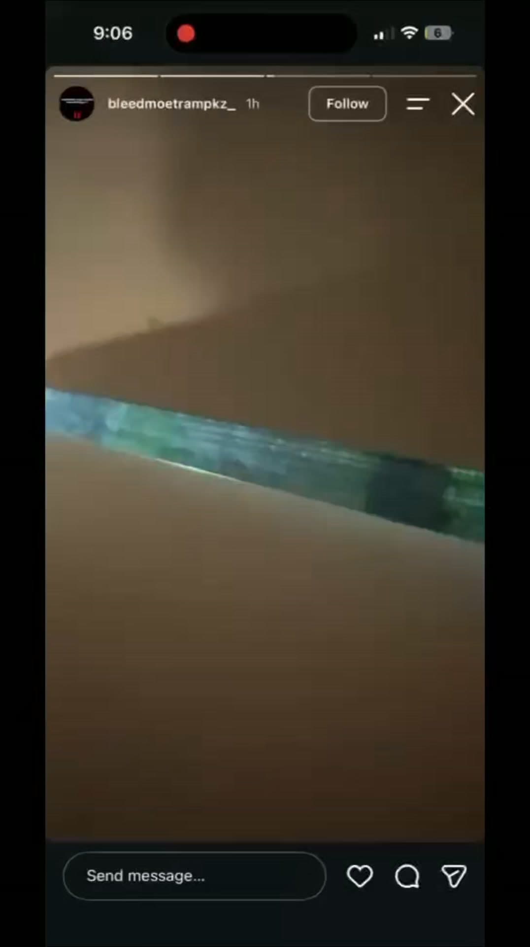 Update from parent from last night's juvie that was stabbed.